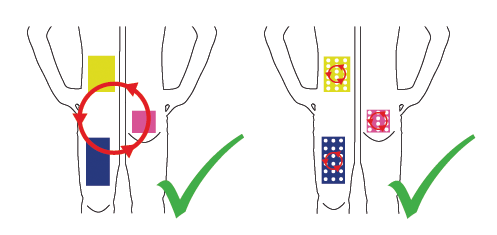 It is recommended to use within the day different injection sites within an area. Every new injection should be at a distance of one fingerbreadth from the last injection site. Change weekly between left and right half of the body.